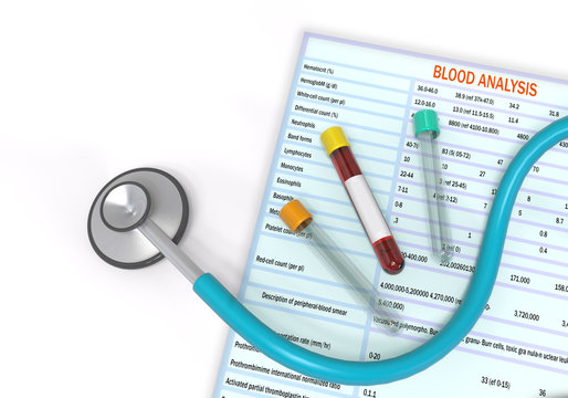 Test analysis result blood test tubes are in the table Concept of the of the diagnosis in a patient 