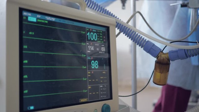 monitoring vital sign of patient under anesthesia in operating room, cardiogram monitor showing human heart rate during surgical operation