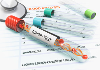 Tumor test analysis result blood test tubes are in the table Concept of the tumor of the diagnosis in a patient in blood tests, 3D illustration