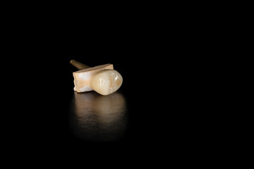 Ceramic tooth crowns and metal pins close-up macro. Orthopedic dentistry restoration of decayed...