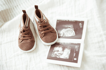 Brown booties next to baby photos with ultrasound. The concept of awaiting baby, pregnancy