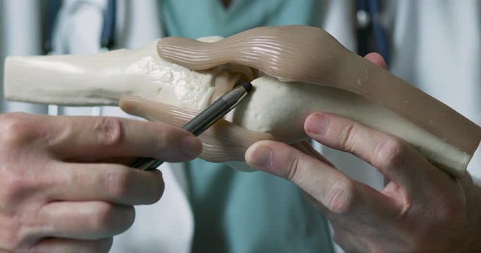 A close up of an orthopedic doctor or surgeon using a skeletal model of a human knee to aid in his explanation of a diagnosis.