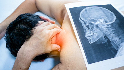 One man use his hand to hold the neck. He felt pain from the neck bone  Herniated Disc and have X-ray film sheet placed near. Concept  neck pain or Cervical Spondylosis.