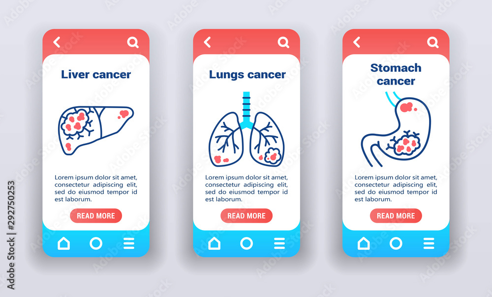 Poster malignant neoplasm, metastases on mobile app onboarding screens. ui ux gui template.