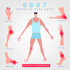 Gout arthritis infographic