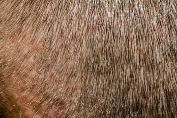 Close-up for head with short hair cut.