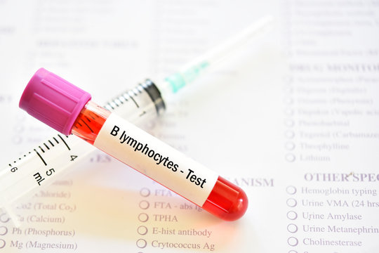 Blood sample tube for B lymphocytes or B cells test
