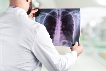 Naklejka premium Young man doctor holding x-ray