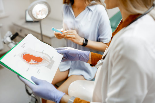 Gynecologist showing a picture with uterus to a young woman patient, explaining the features of women's health during a medical consultation in the office