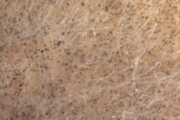 Rhizopus (bread mold) is a genus of common saprophytic fungi,Rhizopus (bread mold) under the microscope.