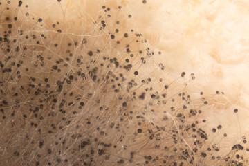 Rhizopus (bread mold) is a genus of common saprophytic fungi,Rhizopus (bread mold) under the microscope.