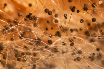 Rhizopus (bread mold) is a genus of common saprophytic fungi,Rhizopus (bread mold) under the microscope.
