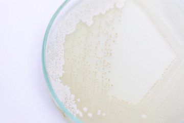 Colony Characteristics of Yeast in petri dish for education.