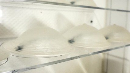 Different sizes breast implants on the table at beauty clinic . Breast augmentation, enlargement, enhancement. Cosmetic surgery. Silicone breast implant. Plastic surgery. Mammaplasty