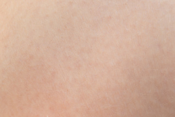 Macro of human skin. Human skin texture