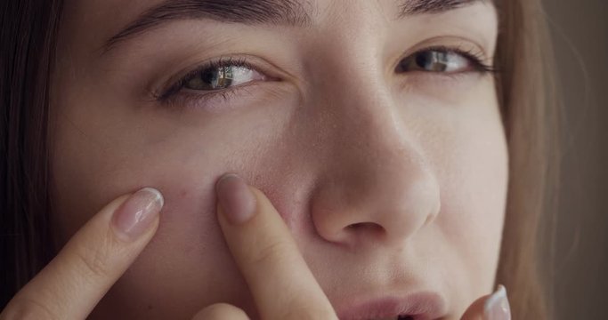 Beautiful young girl touches pimple on face by hands.