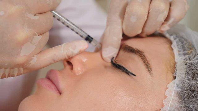 Beauty clinic concept. Close-up of beautician hands making botox injection to female face. Young woman gets facial injectiononal procedure.. Facial rejuvenation. 4k