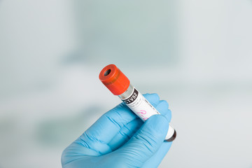Doctor's hand with medical glove holding a blood probe. in front of a lab