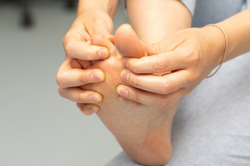 A closeup view on the underside of the foot of a caucasian woman, separating the toes to take a...
