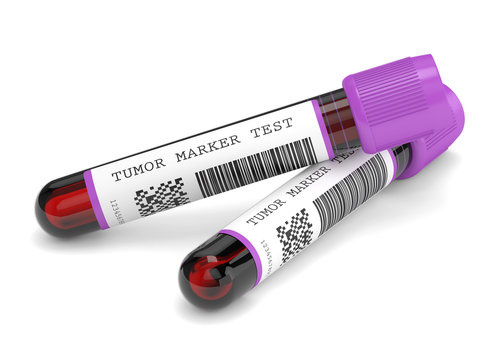 3d render of  blood samples with tumor marker test