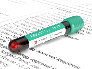 Obraz premium 3d render of blood samples with hepatitis test