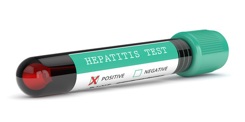 3d render of  blood samples with hepatitis test - obrazy, fototapety, plakaty