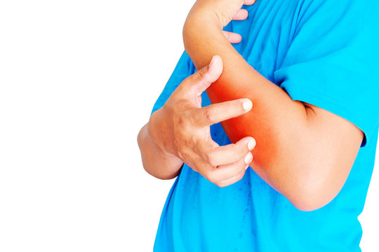  Itching of skin diseases in men using the hand-scratching. Man scratch the arm.