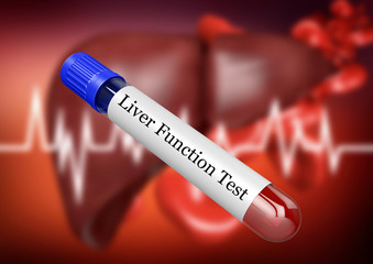 Blood sample in test tube for examination of liver function in laboratory