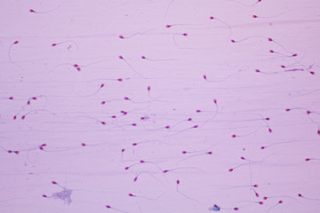 Human sperms viewed in the microscopic 600 x magnification.Spermatozoa on white background.Medical...