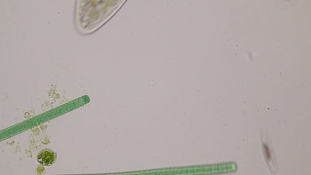 Frontonia sp. is a genus of free-living unicellular ciliate protists under the microscope.