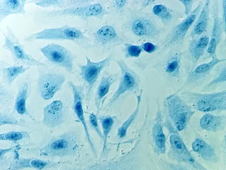 Foto op Plexiglas HeLa cervical cancer cells © heitipaves