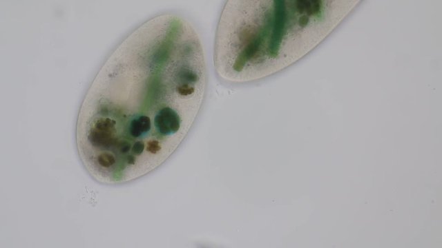 Frontonia sp. is a genus of free-living unicellular ciliate protists under the microscope.