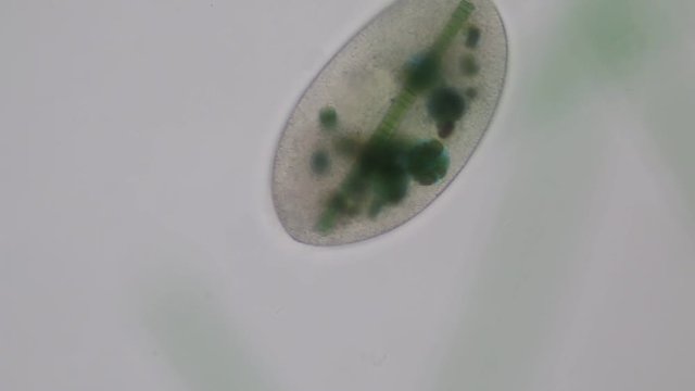 Frontonia sp. is a genus of free-living unicellular ciliate protists under the microscope.