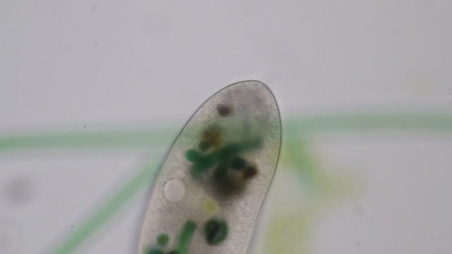 Frontonia sp. is a genus of free-living unicellular ciliate protists under the microscope.