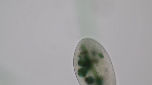 Frontonia sp. is a genus of free-living unicellular ciliate protists under the microscope.