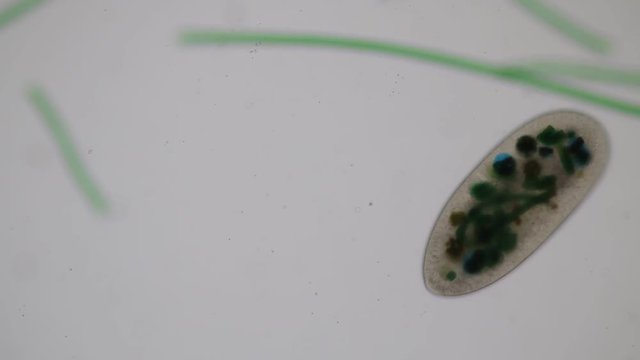 Frontonia sp. is a genus of free-living unicellular ciliate protists under the microscope.