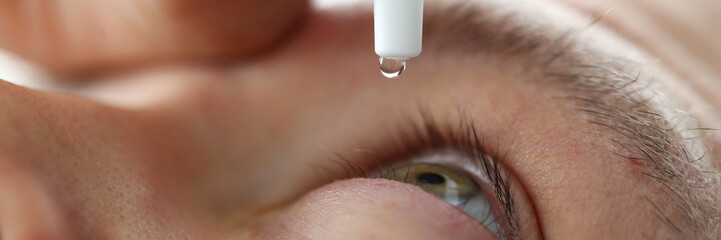 Male hand putting liquid drops in his eye solving vision problem closeup