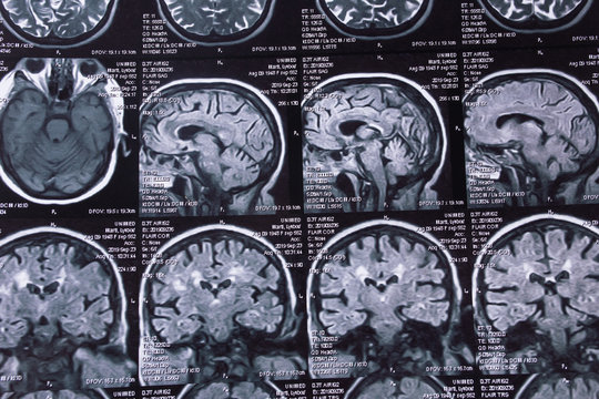 Close-up MRI image. Macro photo.