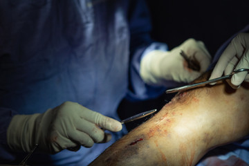 Obraz premium sutura