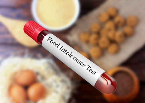 Blood sample in test tube for food intolerance test in laboratory