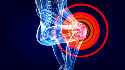 Knee sprain or ache leading to pain 3D illustration