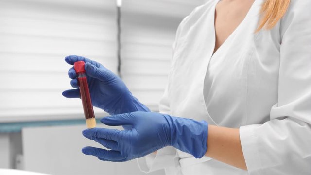 Assistant holds vacuum blood tube with blood sample