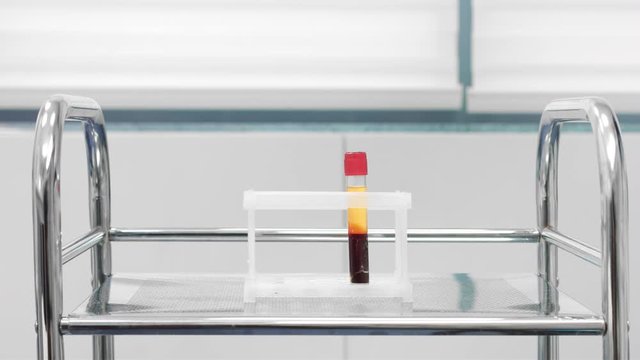 Vacuum blood sample tube with centrifuged blood sample.