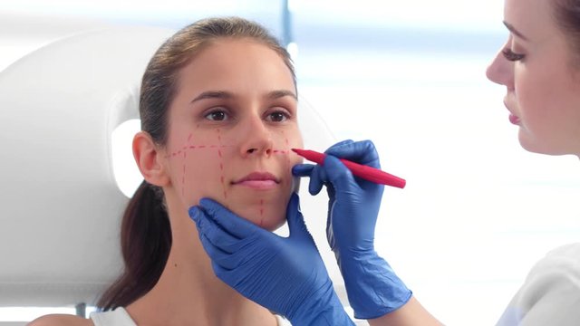 Doctor draws correction lines on patient's face with marker