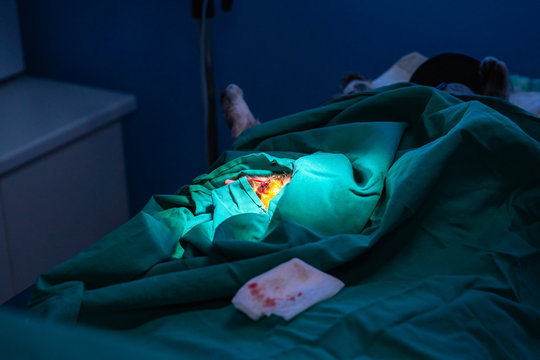 66 BEST Orchiectomy IMAGES, STOCK PHOTOS & VECTORS Adobe Stock