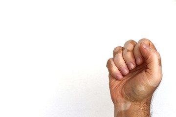 Vitiligo on hand in a fist shape on white isolated background
