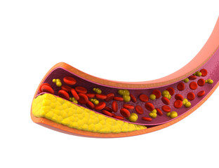 Cholesterol with blood cells. 3d render.