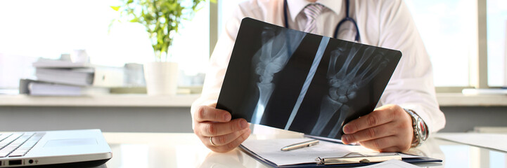 Male doctor hold in arm silver pen and look at xray photography closeup. Skeleton bone disease exam medic aid or cancer physical test in hospital for healthy lifestyle education career concept - obrazy, fototapety, plakaty