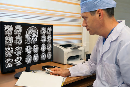 Doctor looking at MRI scan of skull on monitor