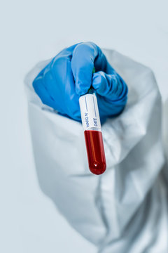 Biologist working with blood samples in the lab